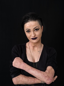 153 DE SECUNDE   Teatru contemporan inspirat de povestea uneia dintre supraviețuitoarele dramei de la Colectiv